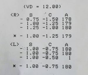 uzman erbaş göz derecesi